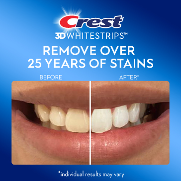 POH_ProShop_Category_Crest_Whitening_364x364_06172024